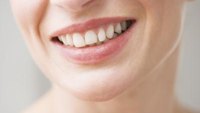 If Teeth Are Brown, Can You Whiten Them? If Teeth Are Brown, Can You Whiten Them?