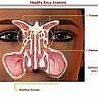 maxillary sinus development