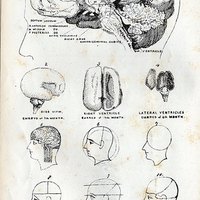 What causes frontal lobe headaches?