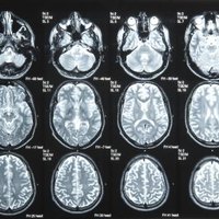 Brain waves increase focus picture 3