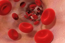 How to Boost Hemoglobin