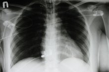 What Causes Wheezing in the Chest?