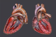 What is Mild Cardiomegaly?