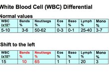 What Is a Shift to the Left in Blood Testing?