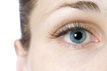 Signs & Symptoms of Eye MRSA