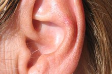 How do I Get Gauged Ears Sewn Up?