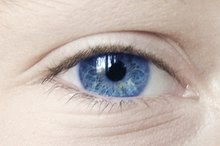 Defect Signs in Iridology