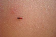 How to Identify Insect & Mite Bites