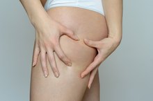 How to Increase Blood Circulation & Reduce Cellulite