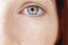 How to Repair Eyebrow Loss