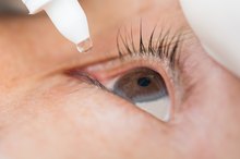How to Remove Eye Mucus