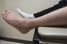 Causes of a Swollen Ankle With No Pain