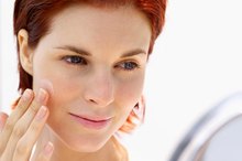 How to Stop Acne Scarring