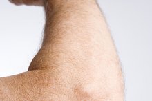 Elbow Skin Pain