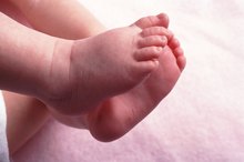 Infant Skin Discoloration