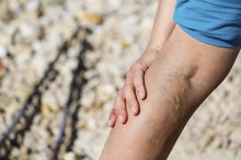The Signs & Symptoms of Vascular Problems in the Legs
