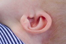 A Crease in an Infant's Ear