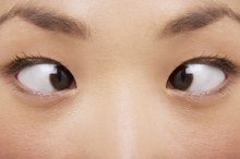 Eye Exercises for Convergence Insufficiency
