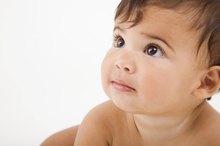 Information on Vitiligo in Babies