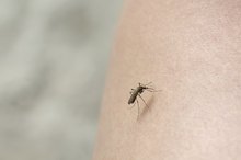 Difference Between a Mosquito & a Chigger Bite