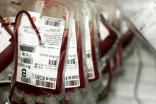 Side Effects From a Blood Transfusion
