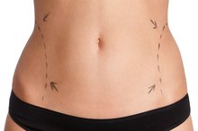 How to Tighten Skin After Liposuction