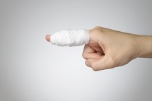 4 Ways to Stabilize and Tape Broken Fingers