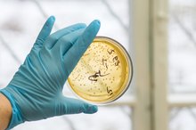 Four Conditions for Bacterial Growth