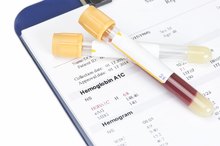 What Are the Normal A1c Levels for Children?