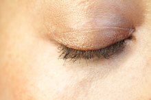 How to Tighten Loose Skin on the Eyelids