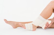 How Long Does it Take to Rehabilitate a Snapped Achilles Tendon?