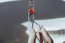 Does Your Iron Have Anything to Do With Your Blood Platelets?