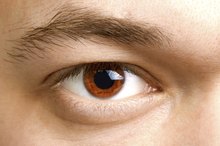 What Eye Problems are Typical With Crohn's Disease?