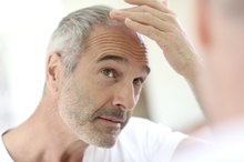 How to Prevent Hair Loss With Lamictal
