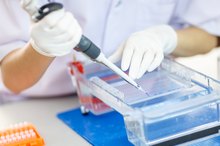 What Are the Benefits of Using Electrophoresis?
