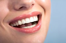 The Effect of Phosphoric Acid on Teeth