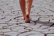 What Are the Causes of Sudden Dry Feet?