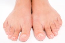 How to Make My Toenail Grow Back Without Fungus