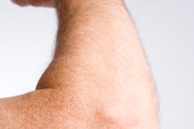 Causes of Painful, Dry Skin on the Elbows