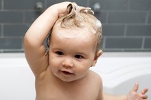 How to Treat Dry Scalp in Babies