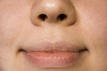How to Treat a Swollen Lip Caused by Trauma