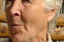 What Are the Causes of Acne Onset in Woman Over 60 Years of Age?