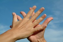 Symptom of Peeling Skin on Hands
