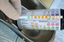 Protein & Blood in Your Urine