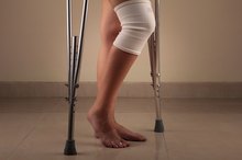How to Straighten a Leg Easier After a Total Knee Replacement