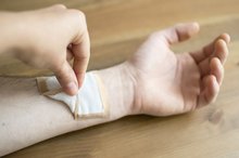How to Remove Gauze That Sticks to Wounds