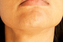 Treatment for Dry Skin on the Chin