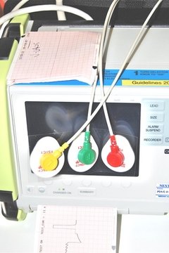 An EKG machine records and allows a heart rhythm to be interpreted.
