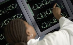 Medioimages/Photodisc/Digital Vision/Getty Images Comprender las radiografías es una responsabilidad laboral compartida por los radiólogos y los técnicos en radiología.