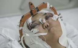 China Photos/Getty Images News/Getty Images La cirugía reconstructiva y estética puede ayudar a corregir deformidades, haciendo posible la vida normal..